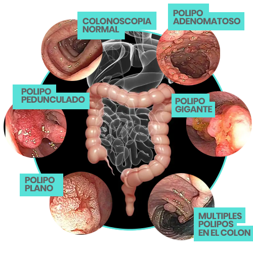 endoscopia, doctor, cirujano, victor sanchez, ciudad juarez